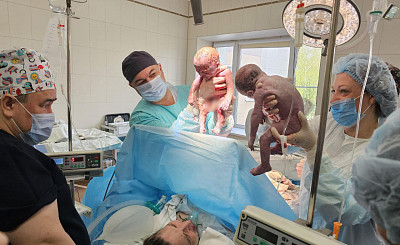 Пациентку с редким видом многоплодия прооперировали врачи в Видном 